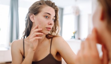 Wykorzystaj maść ichtiolową w pielęgnacji, a ukoisz problematyczną skórę