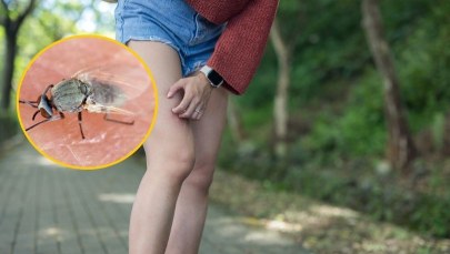 Wyległy masowo i tną do krwi. Lekarze ostrzegają przed jedną rzeczą