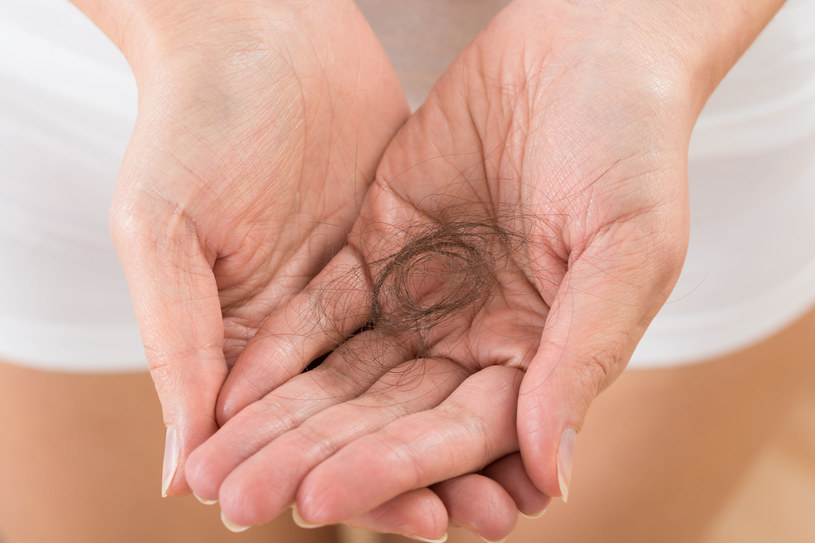 Wypadanie włosów i kruche paznokcie — to może być niedobór biotyny /123RF/PICSEL