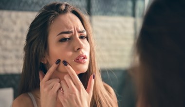 Wypryski i zmiany skórne to problem nawet 40-latków. Winne nie tylko hormony