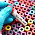 Wysoki cholesterol bez nadwagi? Gdy winne mogą być geny lub problemy z wątrobą