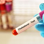 Wysoki cholesterol, czyli jaki? Normy i sposoby na obniżenie cholesterolu