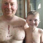 Wytatuował sobie bliznę, żeby wesprzeć synka po operacji serca 
