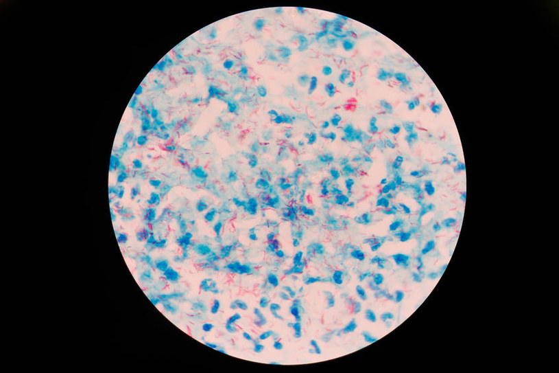 Wywołujące gruźlicę bakterie Mycobacterium tuberculosis pod mikroskopem /123RF/PICSEL