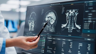 ​Wznowienie przyjęć na oddział neurochirurgii w Radomiu? "Rosną szanse"