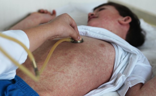 ​Wzrost liczby zachorowań na odrę. "12 razy więcej przypadków niż rok temu"