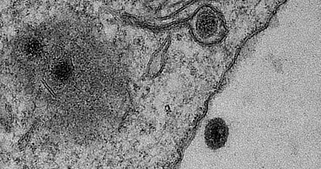 Yaravirus widziany pod mikroskopem. foto: J. ABRAHÃO AND B. LA SCOLA/IHU-MARSEILLE/MICROSCOPY CENTER UFMG-BELO HORIZONTE /materiały prasowe