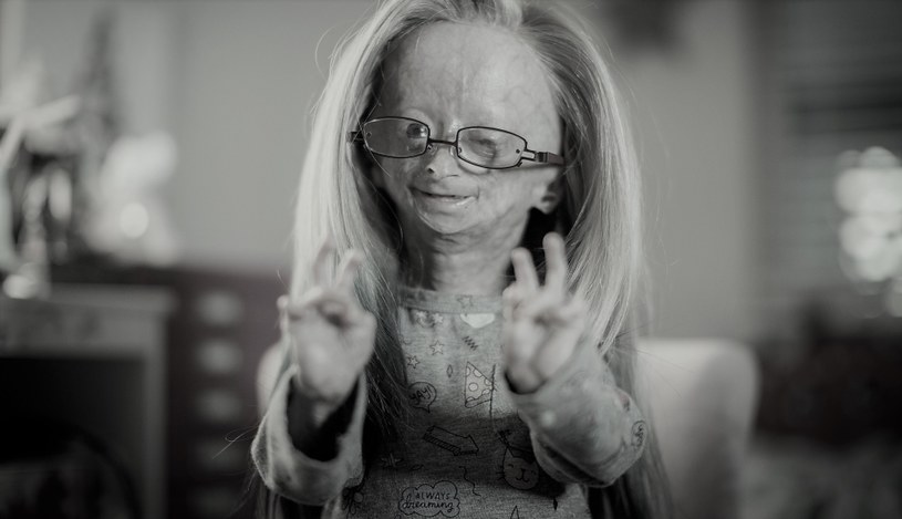 YouTuberka zmarła 12 stycznia. Adalia Rose miała  zaledwie 15 lat /Future Publishing / Contributor /Getty Images