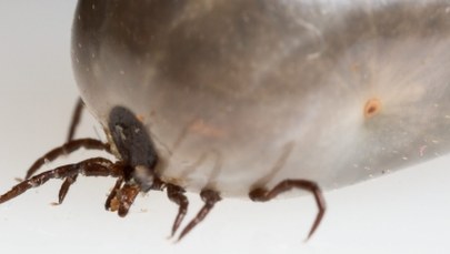 Z kleszczem nie na SOR. Tam możemy spędzić dużo czasu