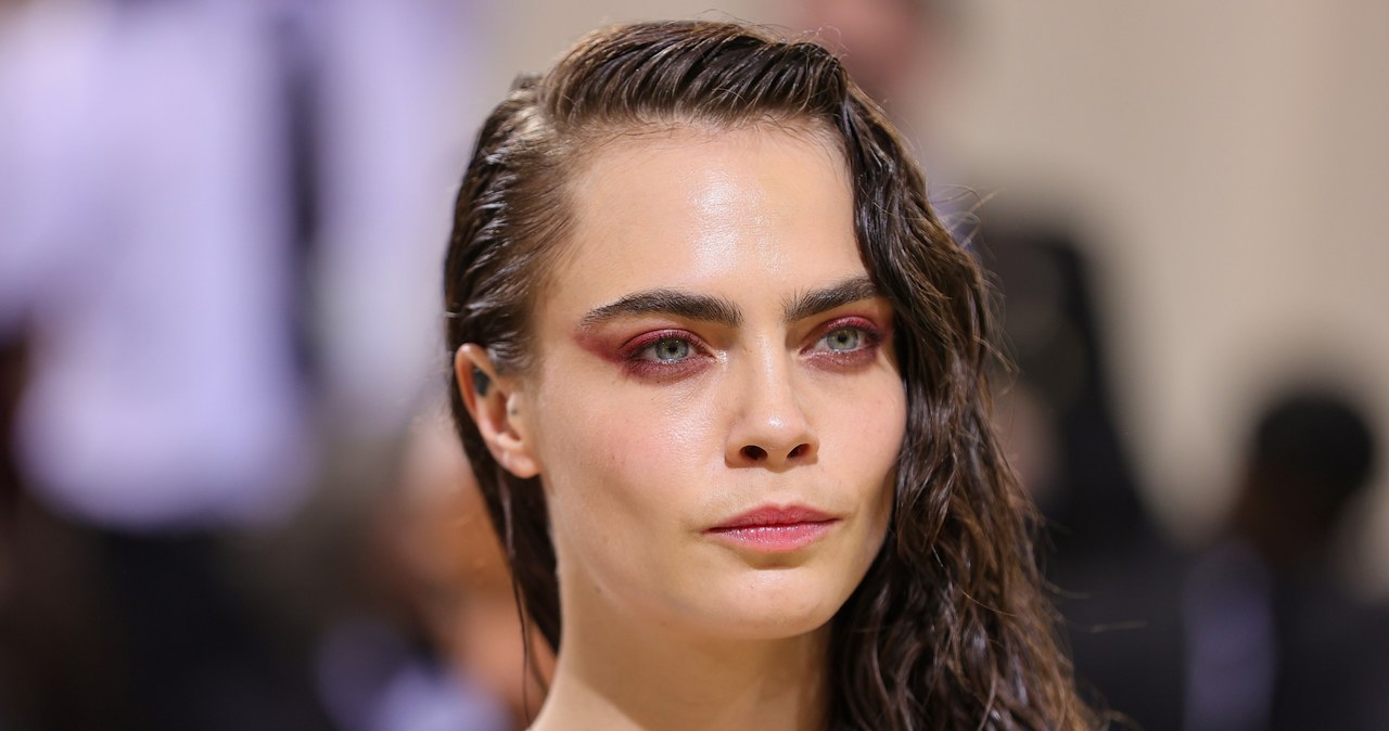 Z łuszczycą boryka się m.in. Cara Delevingne /	Theo Wargo / Staff /Getty Images