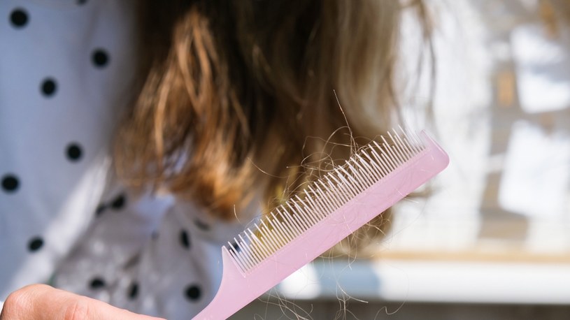 Z nadmierną utratą włosów można poradzić sobie domowymi sposobami. Kiedy te zawiodą, pomogą specjalistyczne zabiegi /123RF/PICSEL