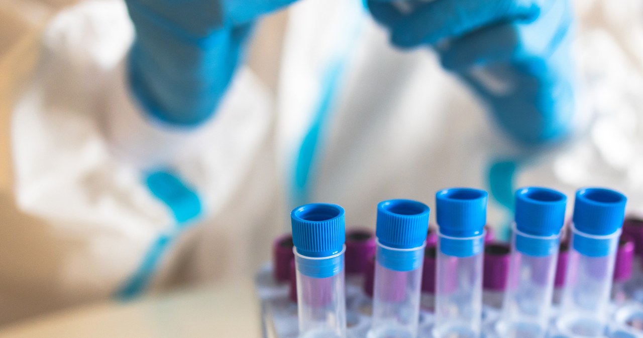 Z nieprawidłowościami związanymi z erytrocytami wiążemy anemię. Ale mogą też pojawić się inne problemy /123RF/PICSEL