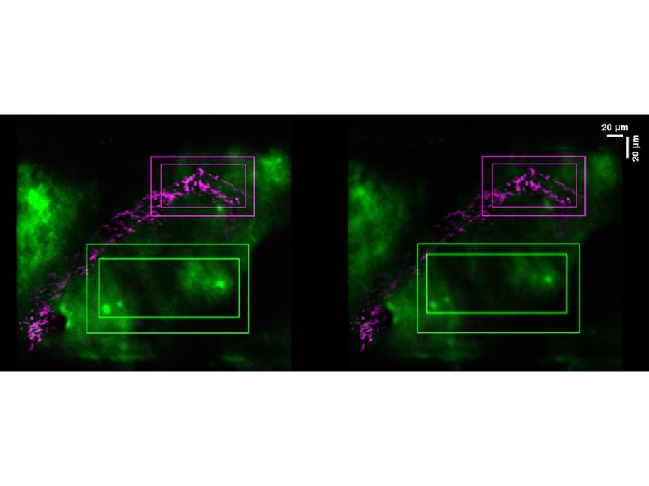 Z pomocą mikroskopii dwufotonowej badacze obserwowali przesunięcie mózgu w chwilach tuż przed ruchem myszy, ale zaraz po napięciu mięśni brzucha. Po lewej mózg, zaznaczony na zielono, w momencie bezruchu, po prawej - podczas ruchu. /Penn State /Materiały prasowe