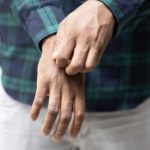 alergia objawy Z roku na rok wzrasta liczba pacjentów hospitalizowanych. "Ludzie boją się podać adrenalinę, ale nie boją się, że ktoś umrze na ich oczach"