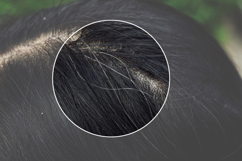 Z siwymi włosami można sobie radzić domowymi sposobami /123RF/PICSEL