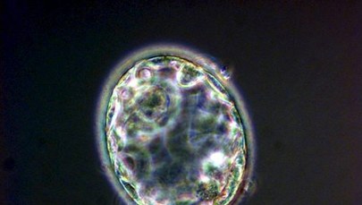 Z wadliwych embrionów zdrowe dzieci?