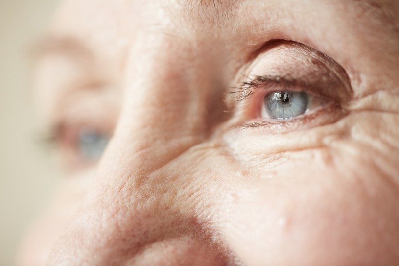 Z zaćmą najczęściej borykają się seniorzy, ale choroba może zostać zdiagnozowana tak naprawdę na każdym etapie życia /123RF/PICSEL