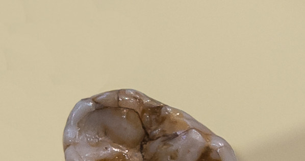 Ząb trzonowy Denisowianina / foto: wikipedia /domena publiczna