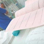 Zaburzenia rytmu serca - tachykardia i bradykardia