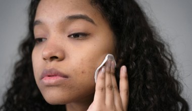 Zaczerwienienia po wyprysku się utrzymują? Okład z rumianku pomoże w 5 minut