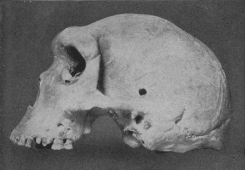 Zagadka tajemniczej czaszki frapuje naukowców już do blisko 100 lat /Wikimedia Commons /domena publiczna