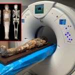 Wrocław Zagadka tajemniczej mumii z Wrocławia rozwiązana. To ośmioletni chłopiec