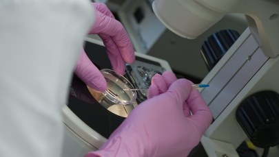 Zainteresowanie refundacją in vitro przerosło oczekiwania