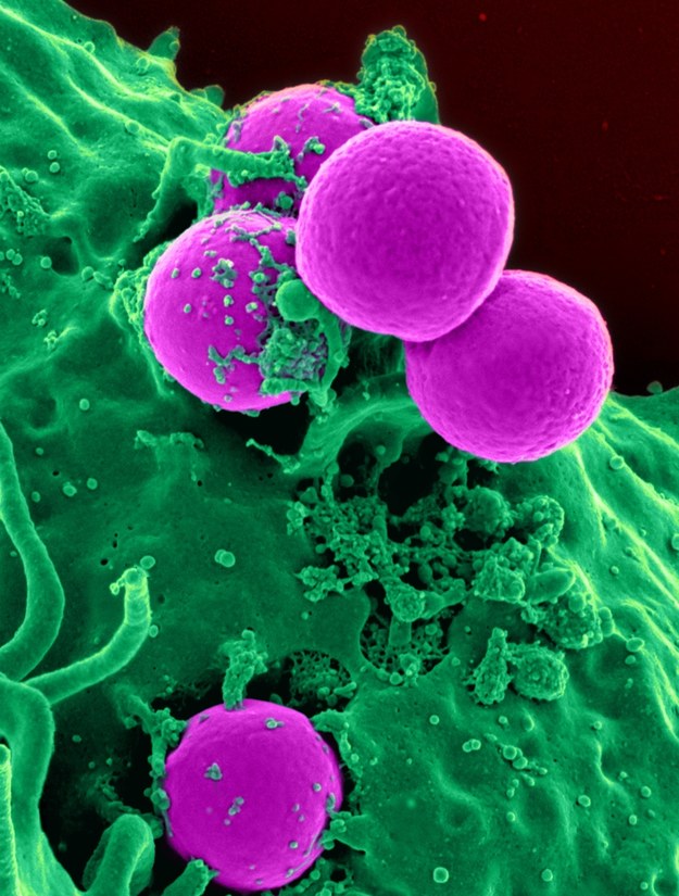 Zakażenia bakteriami antybiotykoodpornymi corocznie powodują na świecie setki tysięcy zgonów / inf. prasowa /&nbsp