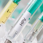 Zakażenie wirusem HPV. Groźniejsze niż myślisz