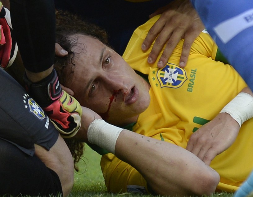 Zakrwawiony David Luiz podzas meczu Brazylii z Meksykiem /AFP