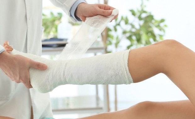 Zamiast gipsu, lekarz może założyć... 