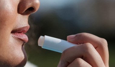 ​Zamiast kupnymi szminkami smaruję usta tym. Są gładkie i nawilżone nawet w mrozy