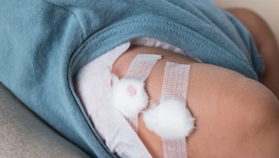 Zaniedbane niemowlę trafiło na OIOM. Zachowanie rodziców zdumiewa