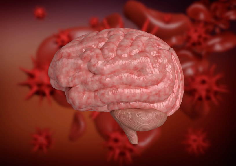 Zapalenie opon mózgowo-rdzeniowych to jeden z najczęstszych symptomów neuroboreliozy /123RF/PICSEL
