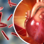 Zapalenie wsierdzia. Co się dzieje gdy drobnoustroje atakują serce?