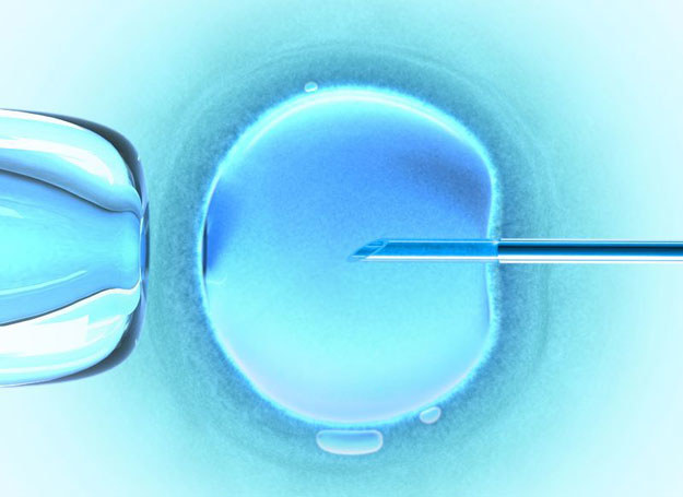 Zapłodnienie pozaustrojowe to metoda rozrodu wspomaganego /123RF/PICSEL