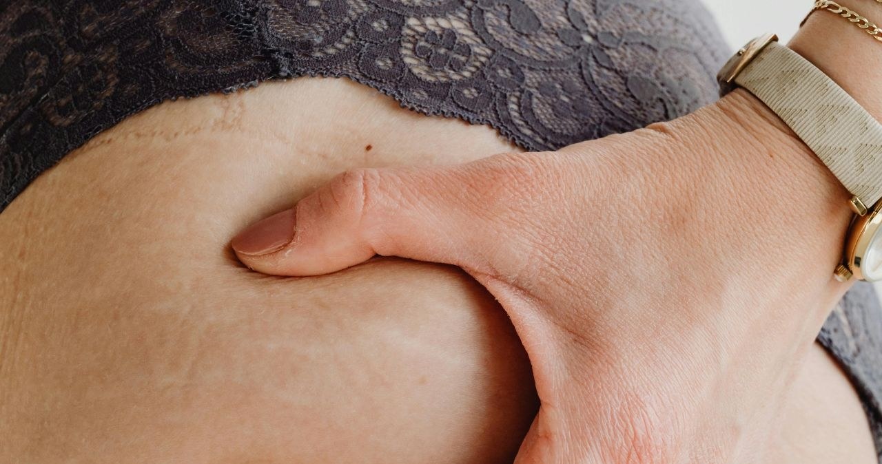 Zapomnij o drogich kremach – ten scrub wygładzi skórę naturalnie / Kaboompics.com /pexels.com