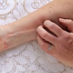 Zapomnij o suchej i szorstkiej skórze zimą. Tak przywrócisz jej gładkość