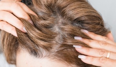 Zaskakujące efekty stosowania wcierki z rozmarynu na włosy. Zrobisz za grosze, a opóźnisz siwienie