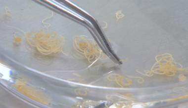 Zaskakujący pomysł Polaków. Pasożyt z Bałtyku ma pomóc ludziom