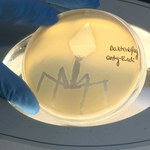 Zaskakujący wynalazek Polaków. Zdrowsze i lepsze od antybiotyków
