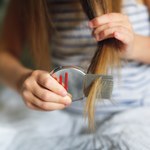 Zastosuj profilaktykę, zanim będzie za późno. Tak rozpoznasz gnidy we włosach 