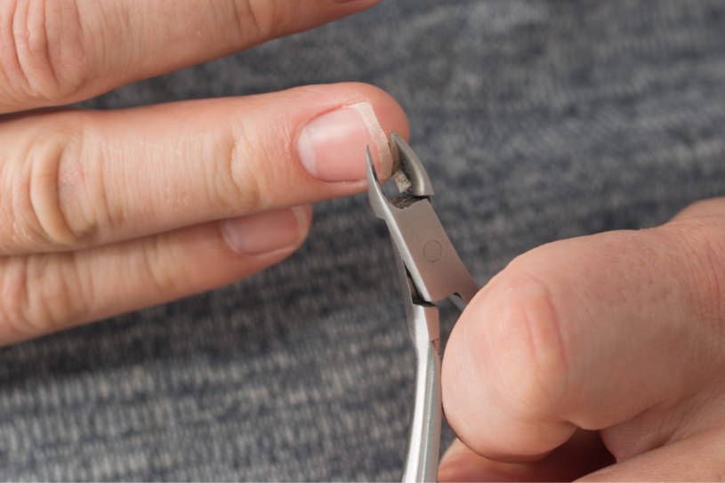 Zastrzał może być spowodowany obgryzaniem paznokci lub skórek, skaleczeniem lub nieprawidłowo wykonanym manicure /123RF/PICSEL