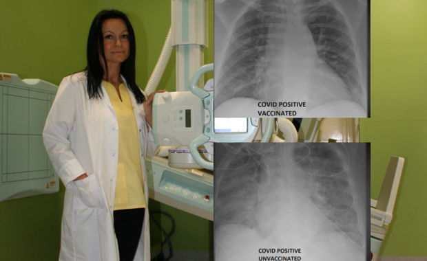 Zaszczepiony i niezaszczepiony z Covid-19. Radiolog opisuje RTG ich płuc 