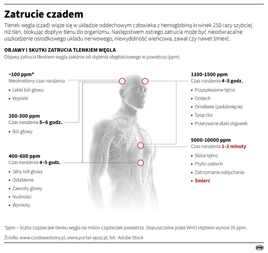 Zatrucie czadem /Mateusz Krymski /PAP