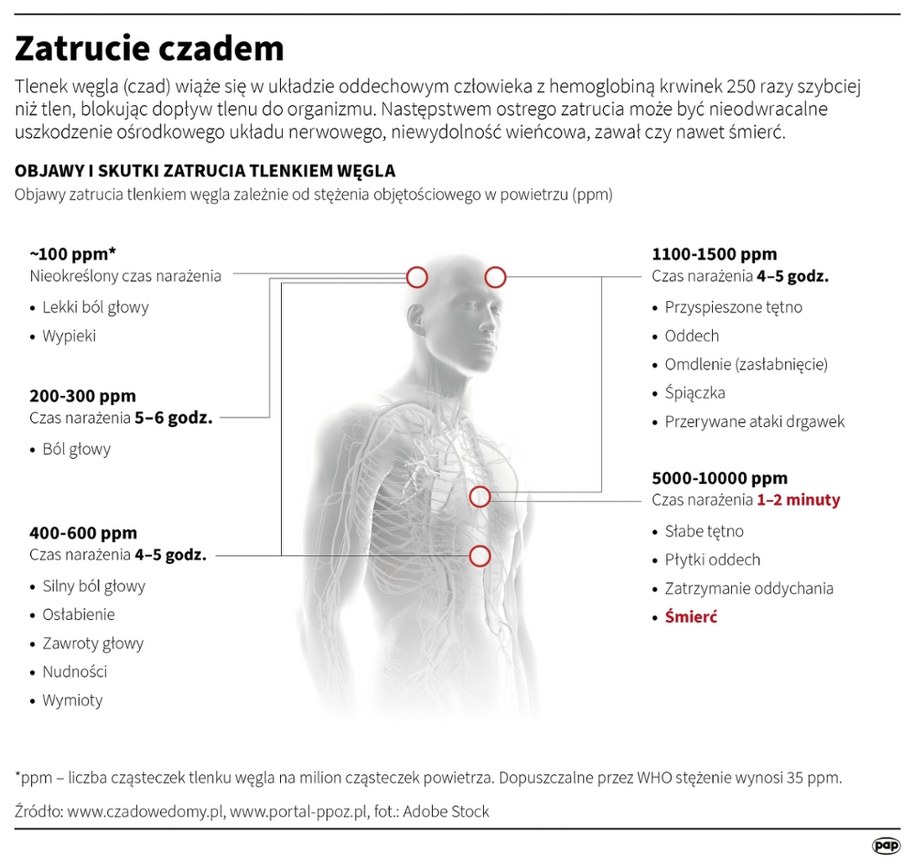 Zatrucie czadem /Mateusz Krymski /PAP