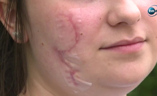 Zatrzymano kolejną osobę ws. okaleczenia dwóch dziewczyn z Katowic 