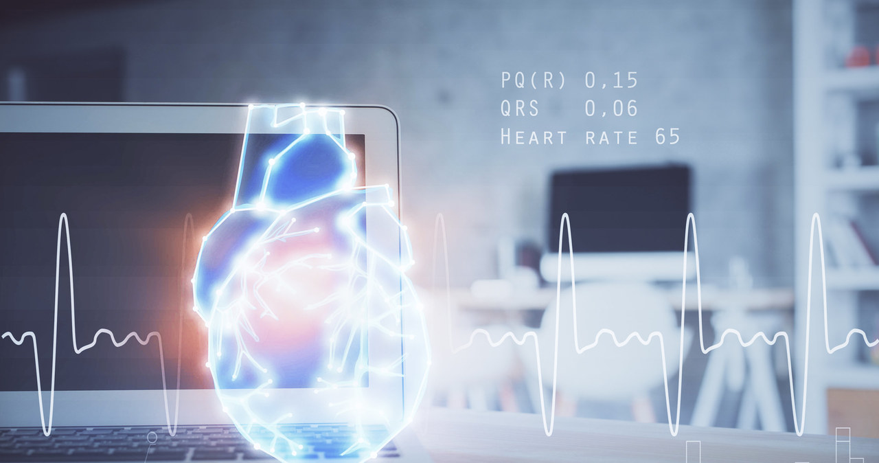 Zawał serca da się przewidzieć - pomoże algorytm sztucznej inteligencji /123RF/PICSEL
