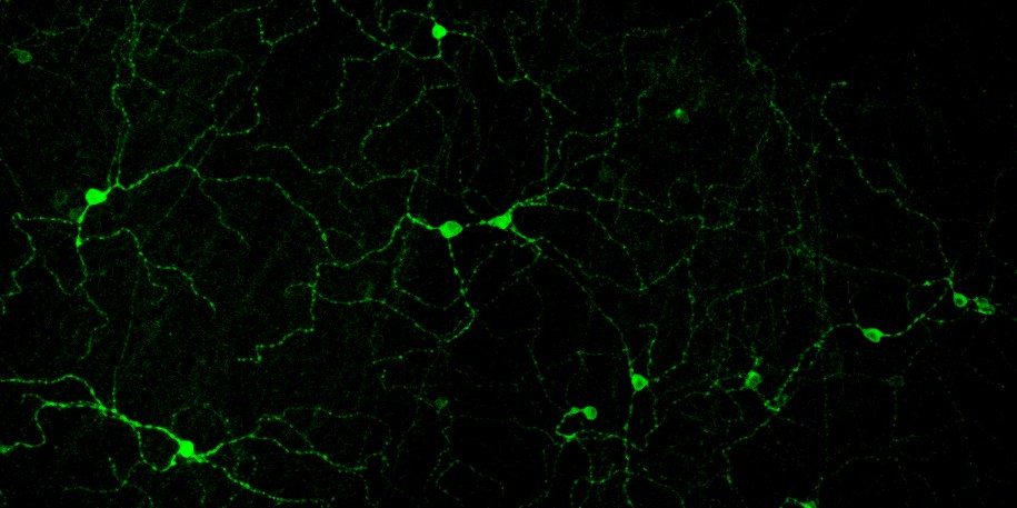 Zawierające melanopsynę komórki siatkówki oka myszy /Elliott Milner i Michael Do, Boston Children's Hospital /Materiały prasowe