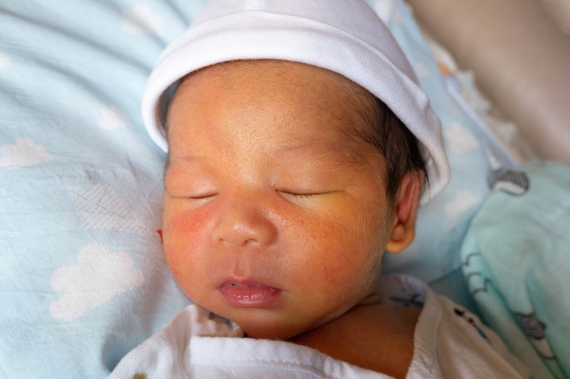 Zażółcenie skóry w wyniku żółtaczki fizjologicznej występuje u prawie 40 proc. zdrowych noworodków /123RF/PICSEL